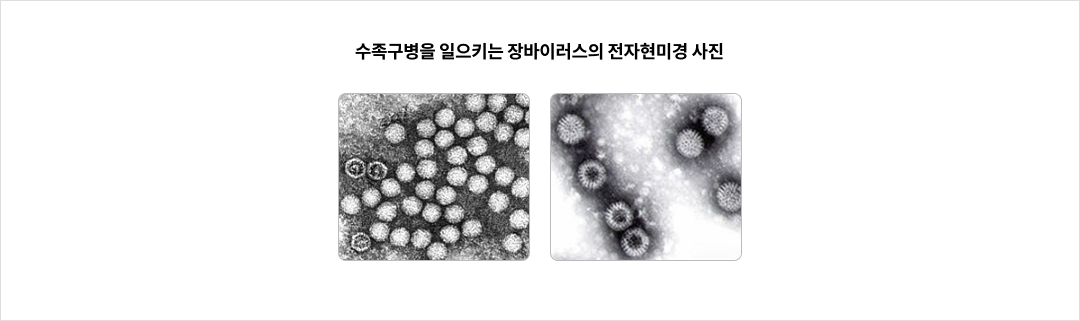 mgz_hand-foot-and-mouth disease_img1_pc.png 수족구병을 일으키는 장바이러스의 전자현미경 사진